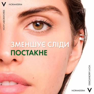 сыворотка-пилинг для коррекции недостатков жирной и проблемной кожи лица vichy normaderm probio-bha serum фото